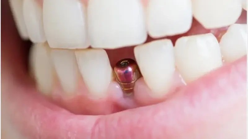 Dental