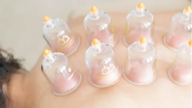 The Science Behind Cupping Therapy and Holistic Wellness