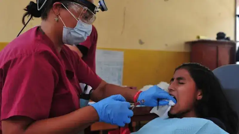 Tooth Extraction