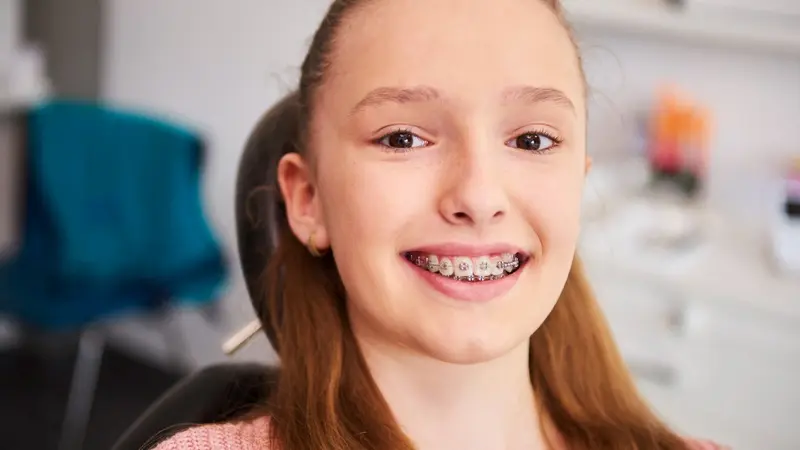 Dental Braces