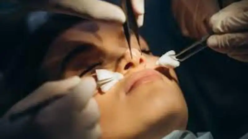 Why Are More People Choosing to Get a Nose Job in Dubai