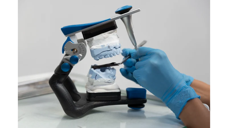 Understanding Dental Implants